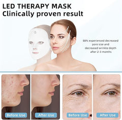 Blue Light Therapy Mask for Face Acne, Red LED Light Therapy Device